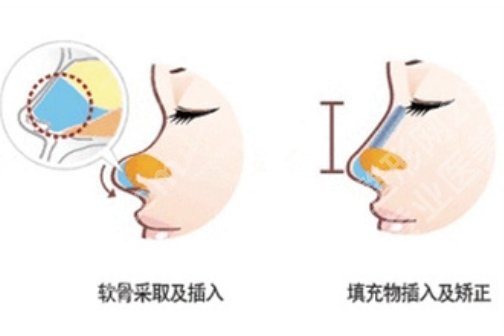 上海唐文齐医生鼻子怎么样?看近期网友点评