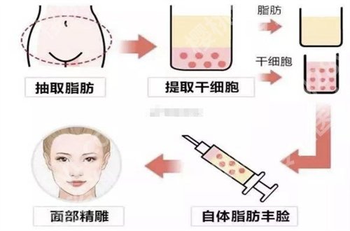 任钟赫医生技术怎么样?明星项目已经阐述