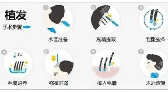 四川省人民医院植发价格是多少?2025价格表更新