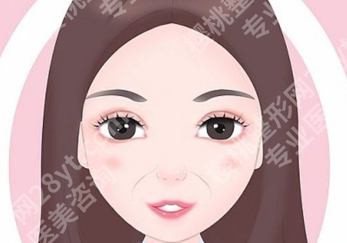 哈尔滨瑞丽的鲁文起主任做双眼皮怎么样?医生简介及双眼皮案例更新!