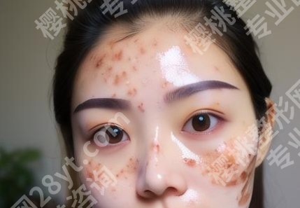 大连医科大学附属第一医院整形美容外科怎么样?案例鉴赏