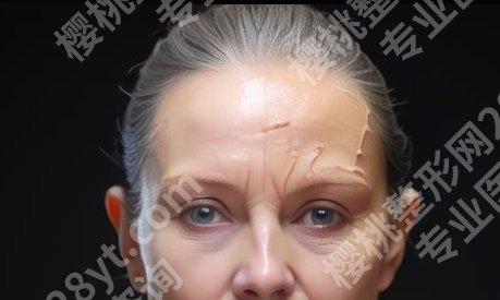 苏州康美美容医院玻尿酸怎么样?注射除皱的效果好吗?