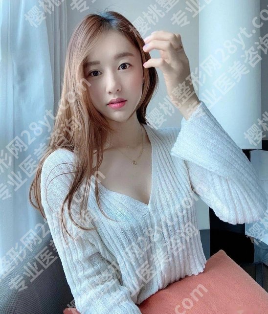 上海管果医生双眼皮做的怎么样?了解医生简介_与经典案例速看