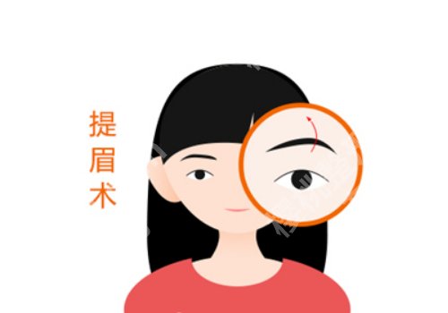 吴丽丽医生提眉怎么样?详细介绍、口碑点评、明星项目