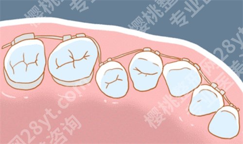 上海第七人民医院牙齿矫正多少钱?医生信息介绍