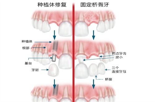 漯河市二院牙科怎么样?正畸技术好吗?全面解析