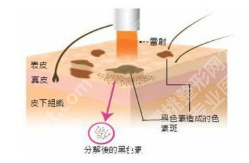任月娥医生怎么样?医院简介、擅长项目
