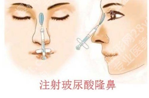 重医附二院隆鼻怎么样?科室核心项目介绍