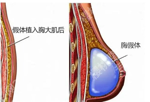 何金光医生简介?特色项目介绍