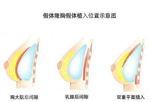 亓发芝隆胸怎么样?个人简介内容公布