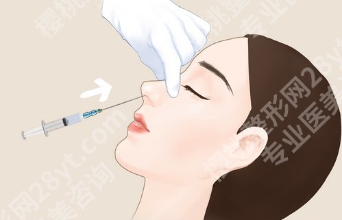上海柴云医生做的鼻子怎么样?口碑点评