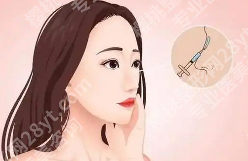上海柴云医生做的鼻子怎么样?口碑点评