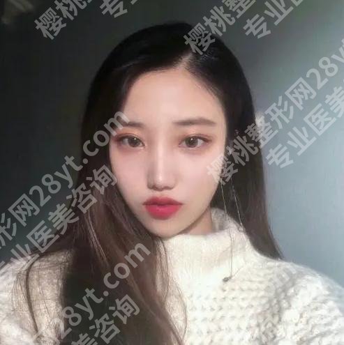 袁玉坤个人简历怎么样?了解医生口碑点评,附案例过程来啦