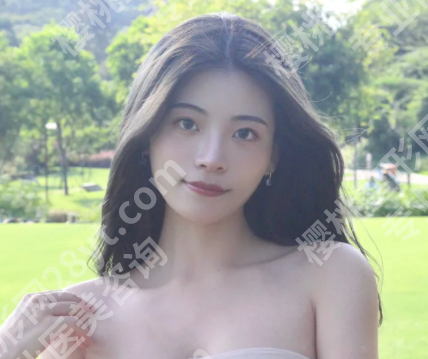 上海美莱何祥龙口碑怎么样?含人气医生介绍,查看双眼皮案例详情