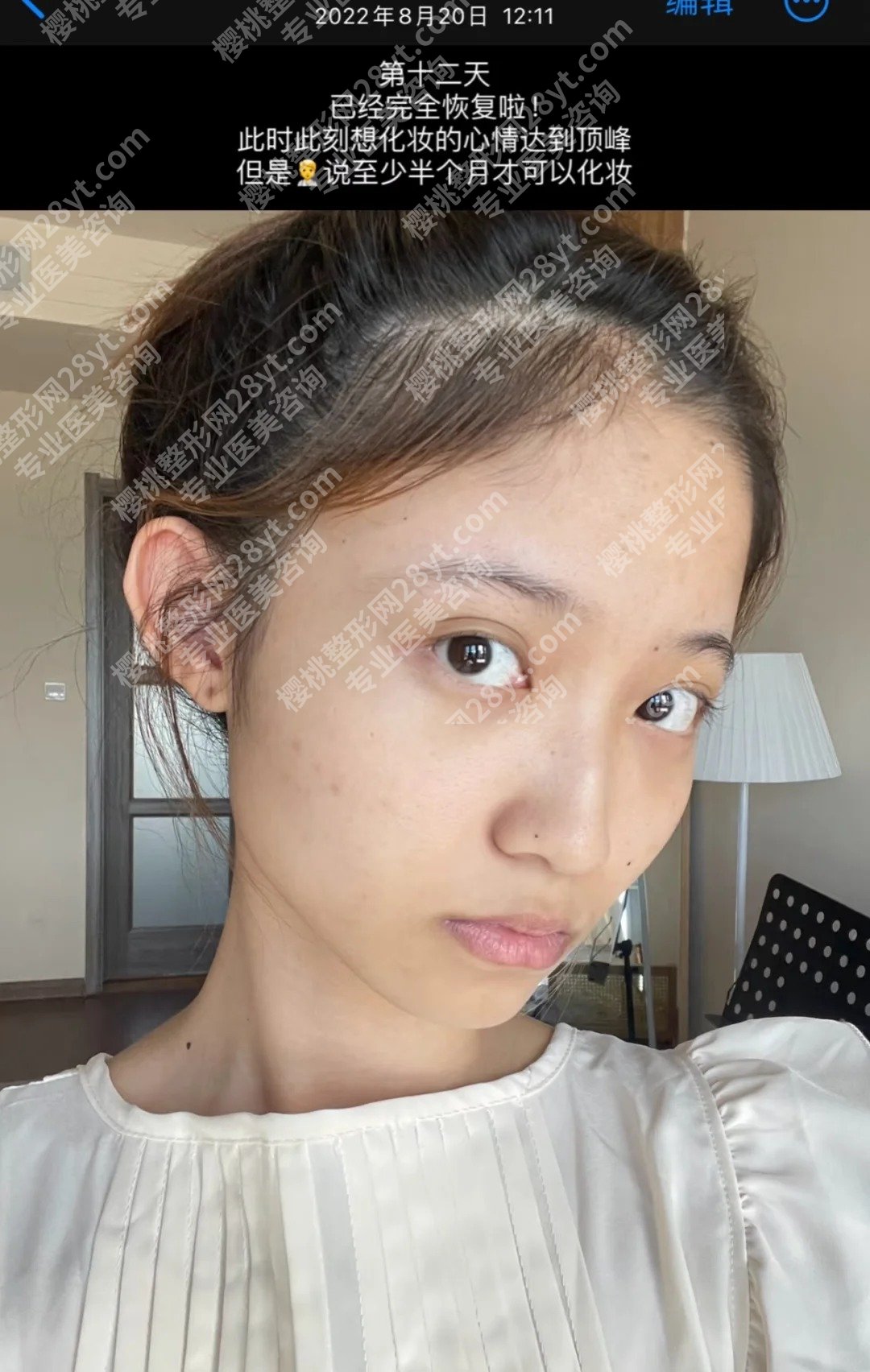 长沙做内切去眼袋哪里好?2025医院排行榜名单出炉!