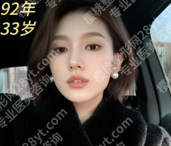 黄寅守做拉皮怎么样?医生口碑测评+真人拉皮案例图反馈!