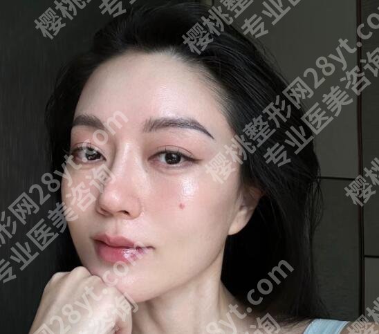 黄寅守做面部提升怎么样?医生基本信息+真实案例分享!