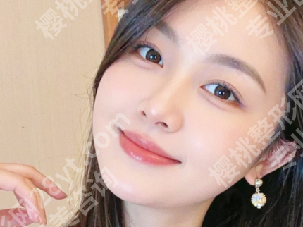内蒙古附属医院割双眼皮怎么样?附有人气医院资料,含手术方式了解