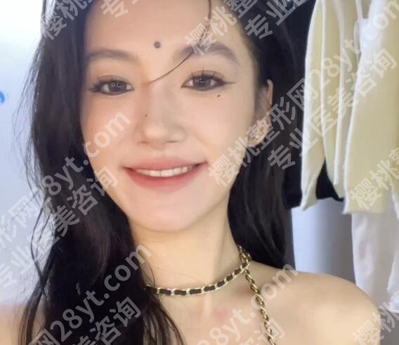 武汉协和整形切痣价格贵不贵?2025项目收费表一览!