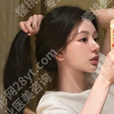 北京协和鼻尖整形价格贵不贵?鼻尖整形案例流程
