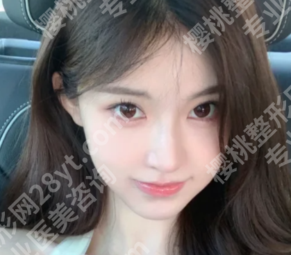 北京巩敏医生降颧骨怎么样?揭晓面诊过程详情