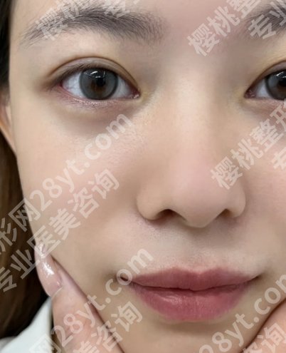 北京美天张洁玲医生怎么样?医生信息、网友反馈、近期案例公开