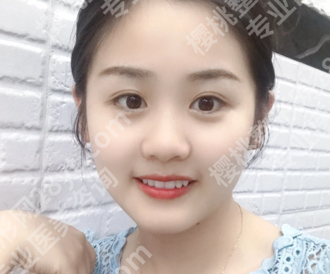 陈明华医生疤痕修复怎么样?一览查看医生点评盘点