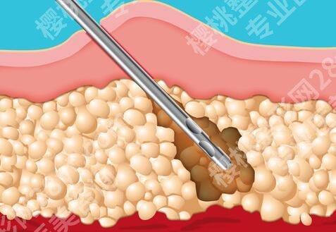 谷延敏医生专业是哪项?查看医生案例过程来了
