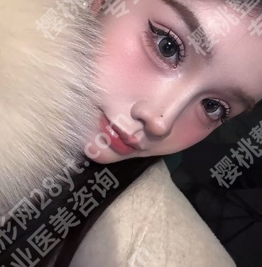 苏州双眼皮医生推荐|端木雪峰、陈光、阳运发等医生人气颇高!