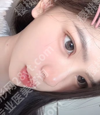 惠州双眼皮医生推荐|洪小芳、赵海星、罗和源等基本信息曝光!