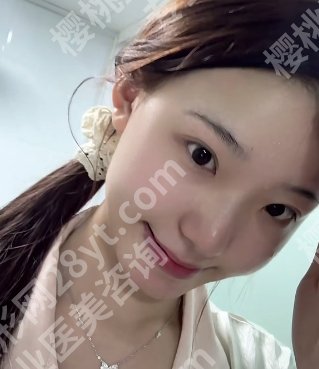广医三院祛斑多少钱?哪位医生做的比较好?科普
