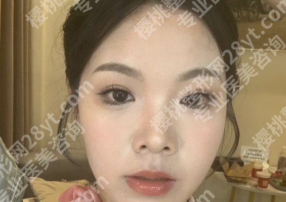 苏州附一院整形科激光价格表一览!医院实力医生点评!收藏再看!