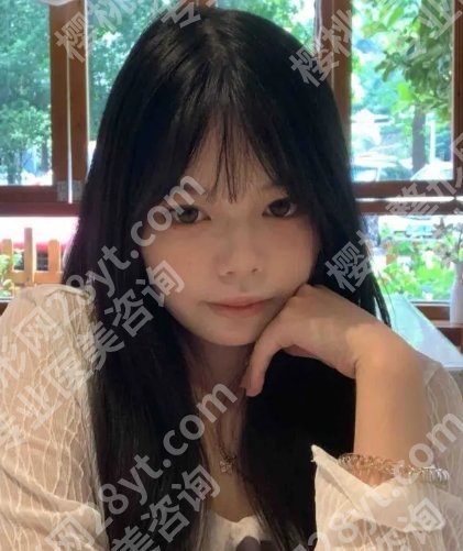 郑恒医生做黄金微针怎么样?医生简介及口碑点评分享