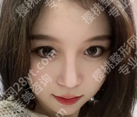 广东省皮肤病医院光子嫩肤多少钱?公布价格标准一览