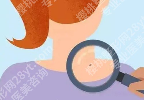 孙娜娜医生切痣怎么样?医生介绍及明星项目分享