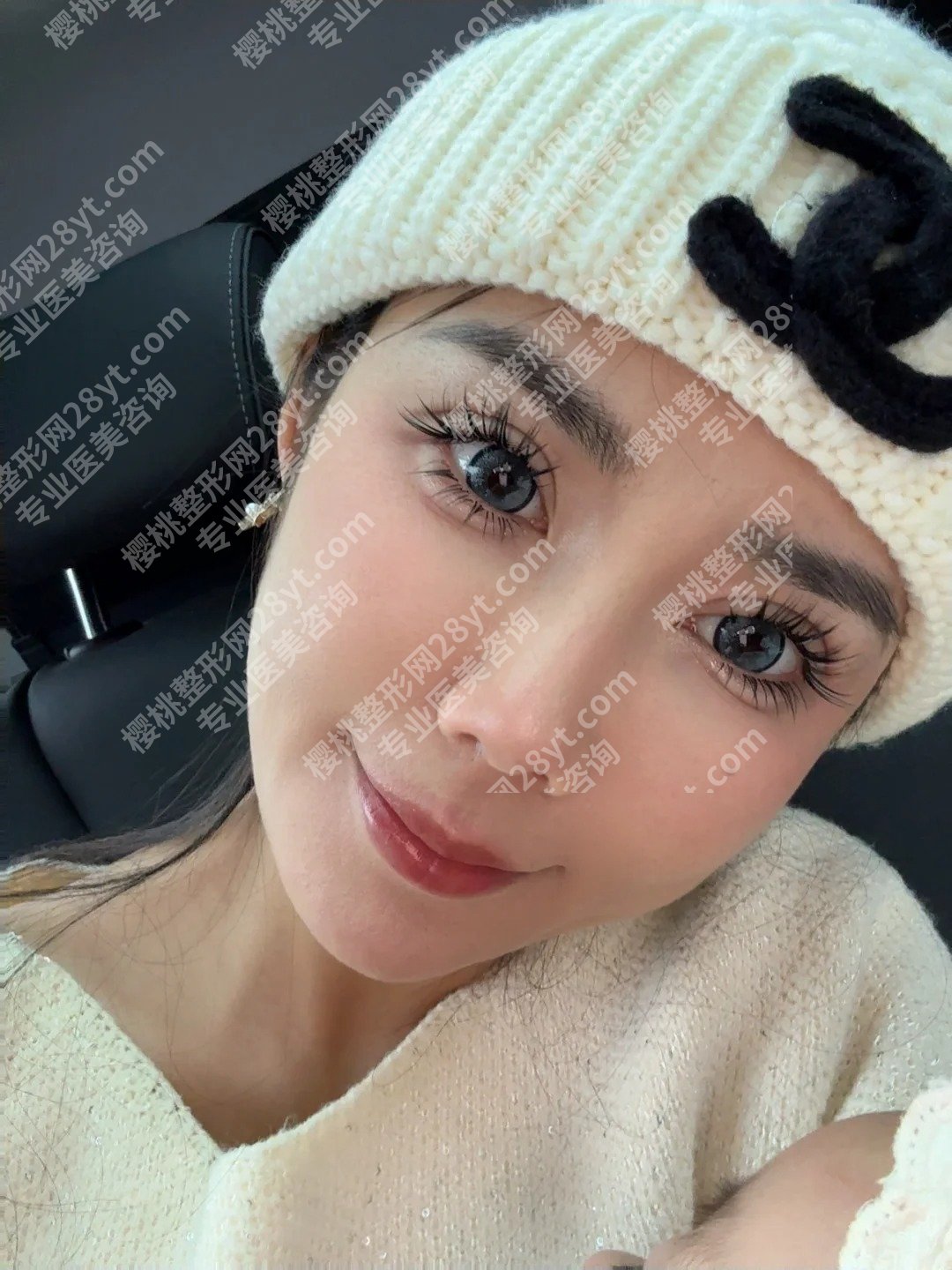 北京三仁医美怎么样?周敏茹、伊光、孙忠慧医生凭实力上榜