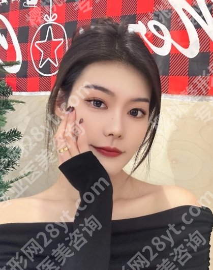 谢立宁做双眼皮怎么样?基本信息及网友体验感反馈