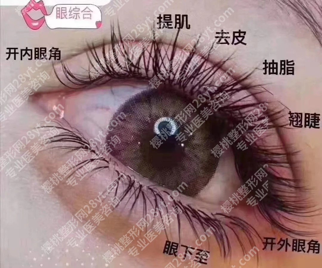 顾勤浩双眼皮价格是多少?全切双眼皮5k起;