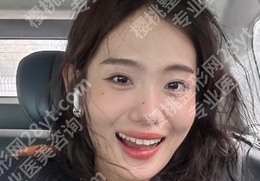 杭州整形美容医院有哪些?艺星、薇琳、美莱通通上榜!