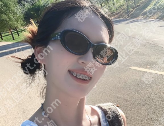 上海第十人民医院牙齿矫正好不好?来看相关介绍!口碑医生及擅长项目!