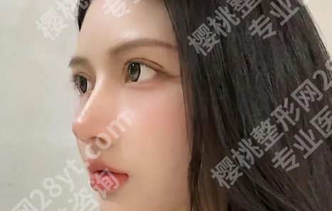 宁波面部除皱医院有哪些?公布前五医院榜单