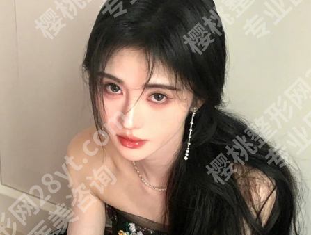 厦门郭彩春医生案例怎么样?速看案例过程一览