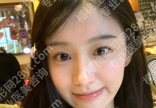 合肥艺星做眼综合怎么样?医院明星医生简介!顾客术后口碑分享!