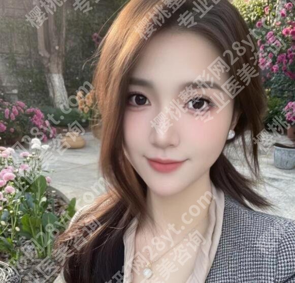 广医三院杨域双眼皮技术怎么样?真人亲身经历分享!