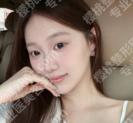 北医三院祛斑做得好吗?口碑怎么样?医院简介+价目表更新!