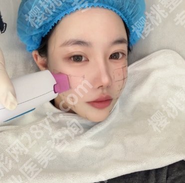 肖文靓医生擅长项目有哪些?抗衰反馈好,有热玛吉授权!