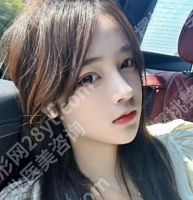 杜良军做鼻子好看吗?技术特点以及真人案例反馈来啦!