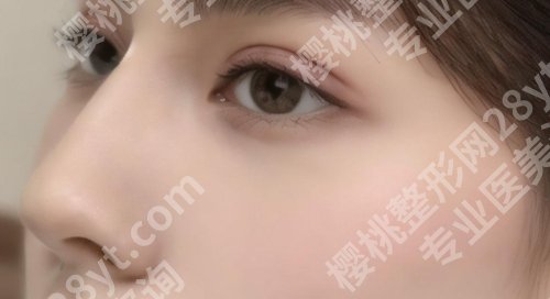 杜良军贵阳华美人气医生信息曝光!鼻部案例、术后tips也有