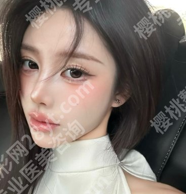 杜良军贵阳华美人气医生信息曝光!鼻部案例、术后tips也有