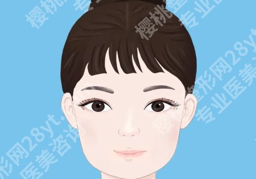 王文凯医生双眼皮怎么样?内附网友反馈、面诊小技巧